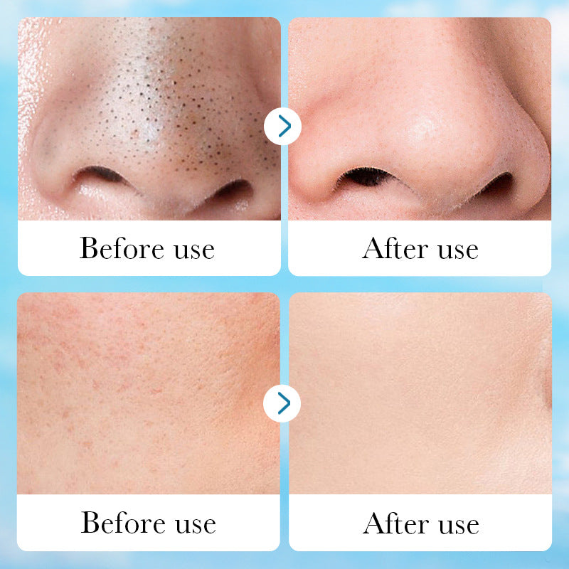 Aloe Pore Clear Solid Mask Cleaning